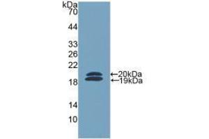 Western blot analysis of recombinant Mouse FCN2. (Ficolin 2 Antikörper  (AA 97-254))