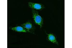 anti-Secernin 1 (SCRN1) (C-Term) antibody