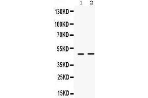 Western Blotting (WB) image for anti-Inhibitor of Growth Family, Member 1 (ING1) (AA 192-223), (Middle Region) antibody (ABIN3042467)