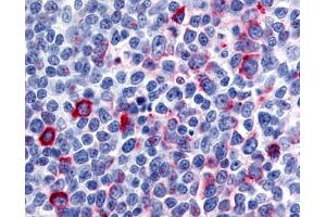 Anti-CCR8 antibody IHC of human tonsil, germinal center. (CCR8 Antikörper  (N-Term))