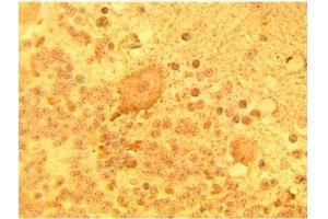 Immunohistochemical staining of normal human brain tissue using DEGS1 Antibody at 15 µg/ml. (DEGS1 Antikörper)