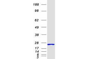 Western Blotting (WB) image for Prostaglandin D2 Synthase (PTGDS) protein (Myc-DYKDDDDK Tag) (ABIN2730061)
