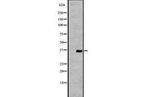 Western blot analysis of extracts from K562 , using OR2V2 antibody. (OR2V2 Antikörper  (Internal Region))