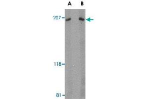Western blot analysis of ARHGEF17 in Jurkat Cell lysate with ARHGEF17 polyclonal antibody  at (A) 1 and (B) 2 ug/mL . (ARHGEF17 Antikörper  (Internal Region))