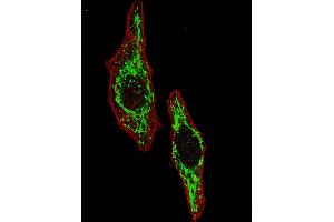Fluorescent image of  cells stained with HSPD1 (Center) antibody. (HSPD1 Antikörper  (AA 187-215))