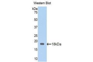 Western Blotting (WB) image for anti-serpin Peptidase Inhibitor, Clade A (Alpha-1 Antiproteinase, Antitrypsin), Member 6 (SERPINA6) (AA 280-405) antibody (ABIN1174372) (SERPINA6 Antikörper  (AA 280-405))
