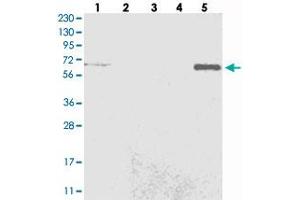 Western blot analysis of Lane 1: RT-4, Lane 2: U-251 MG, Lane 3: Human Plasma, Lane 4: Liver, Lane 5: Tonsil with C6orf190 polyclonal antibody . (THEMIS Antikörper)