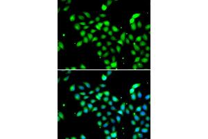 Immunofluorescence analysis of  cells using METTL13 antibody (ABIN6131842, ABIN6143755, ABIN6143757 and ABIN6216265). (METTL13 Antikörper  (AA 430-699))