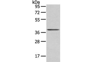 Gel: 8 % SDS-PAGE, Lysate: 40 μg, Lane: Mouse brain tissue, Primary antibody: ABIN7193059(WNT10A Antibody) at dilution 1/200 dilution, Secondary antibody: Goat anti rabbit IgG at 1/8000 dilution, Exposure time: 10 seconds (Protein Wnt-1 (WNT1.L) Antikörper)