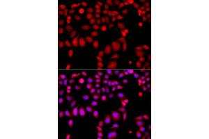 Immunofluorescence analysis of A549 cell using ARHGEF9 antibody. (Arhgef9 Antikörper)