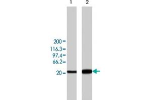Western blot analysis of min6 cells overexpressing rat Camk2d, using Camk2d polyclonal antibody .