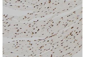 ABIN6277568 at 1/100 staining Mouse heart tissue by IHC-P. (FBP1 Antikörper  (Internal Region))