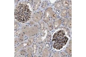 Immunohistochemical staining of human kidney with IL17RE polyclonal antibody  shows strong cytoplasmic and membranous positivity in glomeruli at 1:50-1:200 dilution. (IL17RE Antikörper)