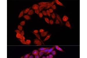 Immunofluorescence analysis of HeLa cells using NRF2 Polyclonal Antibody at dilution of 1:100. (NRF2 Antikörper)