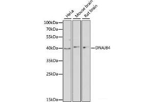Western blot analysis of extracts of various cell lines using DNAJB4 Polyclonal Antibody at dilution of 1:3000. (DNAJB4 Antikörper)