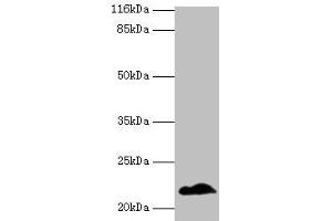Western blot All lanes: NDUFB5 antibody at 2 μg/mL + U251 whole cell lysate Secondary Goat polyclonal to rabbit IgG at 1/10000 dilution Predicted band size: 22, 16 kDa Observed band size: 22 kDa (NDUFB5 Antikörper  (AA 94-189))
