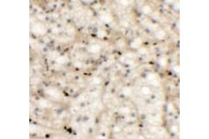 Immunohistochemistry (IHC) image for anti-NK2 Homeobox 6 (NKX2-6) (Middle Region) antibody (ABIN1031022) (NKX2-6 Antikörper  (Middle Region))