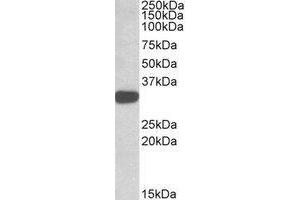 Western blot analysis: TIPRL antibody staining of K562 lysate at 1 µg/ml (35µg protein in RIPA buffer). (TIPRL Antikörper  (C-Term))