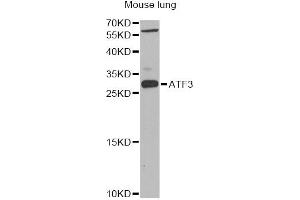 Western blot analysis of extracts of mouse lung, using ATF3 Antibody (ABIN1871129) at 1:1000 dilution. (ATF3 Antikörper)