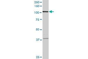 FLJ20097 monoclonal antibody (M01A), clone 2D11. (Syndetin/VPS50 Antikörper  (AA 862-964))