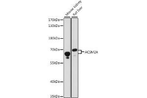 Western blot analysis of extracts of various cell lines, using A antibody (ABIN7265425) at 1:1000 dilution. (ACSM2A Antikörper  (AA 418-577))