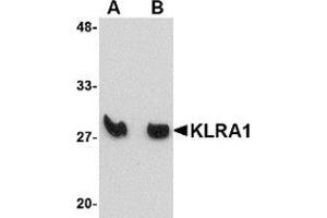 Western blot analysis of KLRA1 in mouse spleen tissue lysate with KLRA1 antibody at (A) 1 μg/ml and (B) 2 μg/ml.