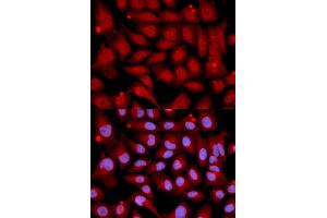 Immunofluorescence analysis of U2OS cells using MAP2K6 antibody (ABIN5971400). (MAP2K6 Antikörper)