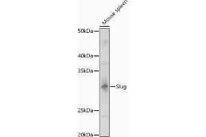 Western blot analysis of extracts of Mouse spleen, using Slug antibody (ABIN3021317, ABIN3021318, ABIN3021319 and ABIN6214866) at 1:1000 dilution. (SLUG Antikörper  (AA 89-268))