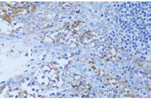 Immunohistochemistry of paraffin-embedded Human tonsil using HADH Polyclonal Antibody at dilution of 1:100 (40x lens). (HADH Antikörper)