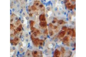 IHC-P analysis of Kidney tissue, with DAB staining. (MMP24 Antikörper  (AA 429-642))