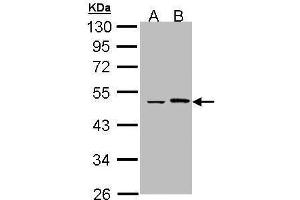 WB Image Sample (30 ug of whole cell lysate) A: Hela B: Hep G2 , 10% SDS PAGE antibody diluted at 1:1000 (EPHX1 Antikörper)