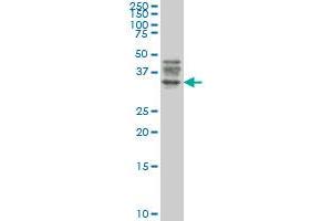 ATG3 monoclonal antibody (M06), clone 1F7 Western Blot analysis of ATG3 expression in Jurkat . (ATG3 Antikörper  (AA 1-100))