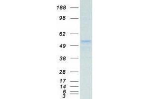 TUBB Protein (Myc-DYKDDDDK Tag)