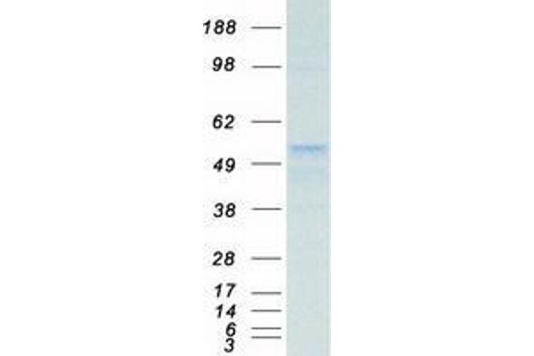 TUBB Protein (Myc-DYKDDDDK Tag)