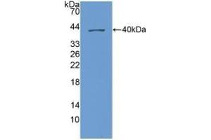 Detection of Recombinant NAP3, Human using Polyclonal Antibody to Chemokine (C-X-C Motif) Ligand 1 (CXCL1)