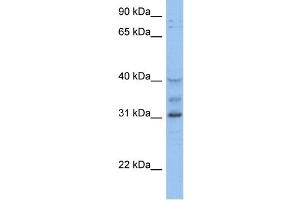 WB Suggested Anti-HOXD1 Antibody Titration:  0. (HOXD1 Antikörper  (C-Term))