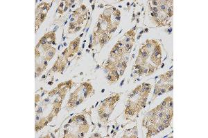 Immunohistochemistry (IHC) image for anti-Cell Division Cycle 34 (CDC34) antibody (ABIN1876645)