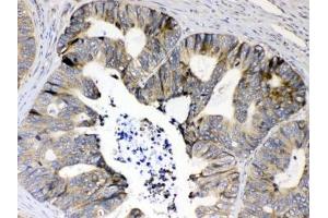 Immunohistochemistry (IHC) image for anti-Ribosomal Protein S6 (RPS6) (AA 13-52) antibody (ABIN5647262)