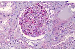 Human Kidney: Formalin-Fixed, Paraffin-Embedded (FFPE) (NLRP3 Antikörper)