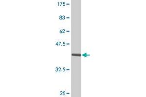 Western Blot detection against Immunogen (39. (FABP1 Antikörper  (AA 1-127))