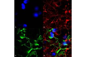 Immunocytochemistry/Immunofluorescence analysis using Mouse Anti-SUR2A Monoclonal Antibody, Clone S319A-14 (ABIN2482980). (ABCC9 Antikörper  (AA 1505-1546) (HRP))