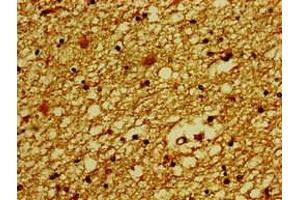 Immunohistochemistry of paraffin-embedded human brain tissue using ABIN7176676 at dilution of 1:100