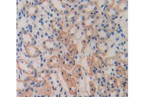 IHC-P analysis of Kidney tissue, with DAB staining. (CISH Antikörper  (AA 79-256))