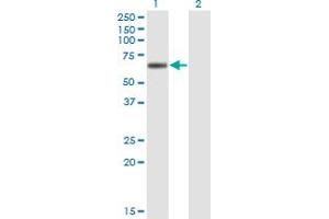 Western Blot analysis of LIPG expression in transfected 293T cell line by LIPG monoclonal antibody (M01), clone 4A9. (LIPG Antikörper  (AA 21-500))