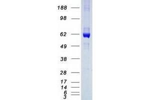 Validation with Western Blot (CES2 Protein (Transcript Variant 1) (Myc-DYKDDDDK Tag))