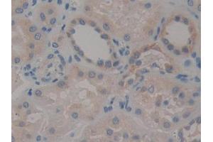 DAB staining on IHC-P; Samples: Human Kidney Tissue (STAT2 Antikörper  (AA 616-849))