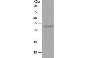 Western Blotting (WB) image for Decorin (DCN) (AA 35-354) protein (His tag) (ABIN7122611)