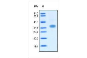 Human Oncostatin M on SDS-PAGE under reducing (R) condition. (Oncostatin M Protein (OSM) (AA 26-252))