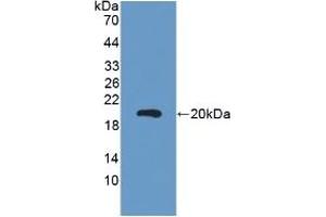 Detection of Recombinant CEA, Mouse using Polyclonal Antibody to Carcinoembryonic Antigen (CEA) (CEA Antikörper  (AA 544-771))