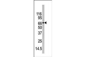 Image no. 1 for anti-Peptidyl Arginine Deiminase, Type IV (PADI4) (C-Term) antibody (ABIN357799) (PAD4 Antikörper  (C-Term))